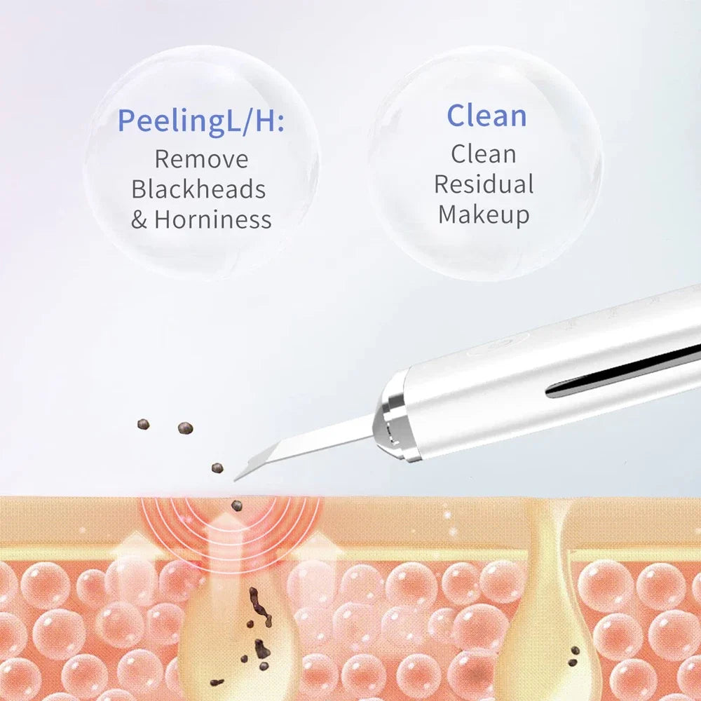 Glow Up: Ultrasonic Facial Scrubber for Radiant, Clear Skin