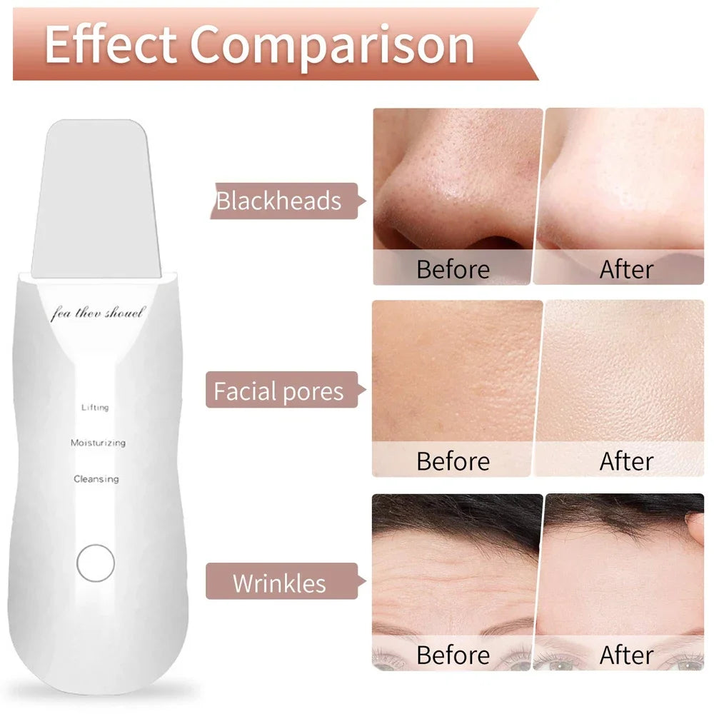 Glow Up: Ultrasonic Facial Scrubber for Radiant, Clear Skin