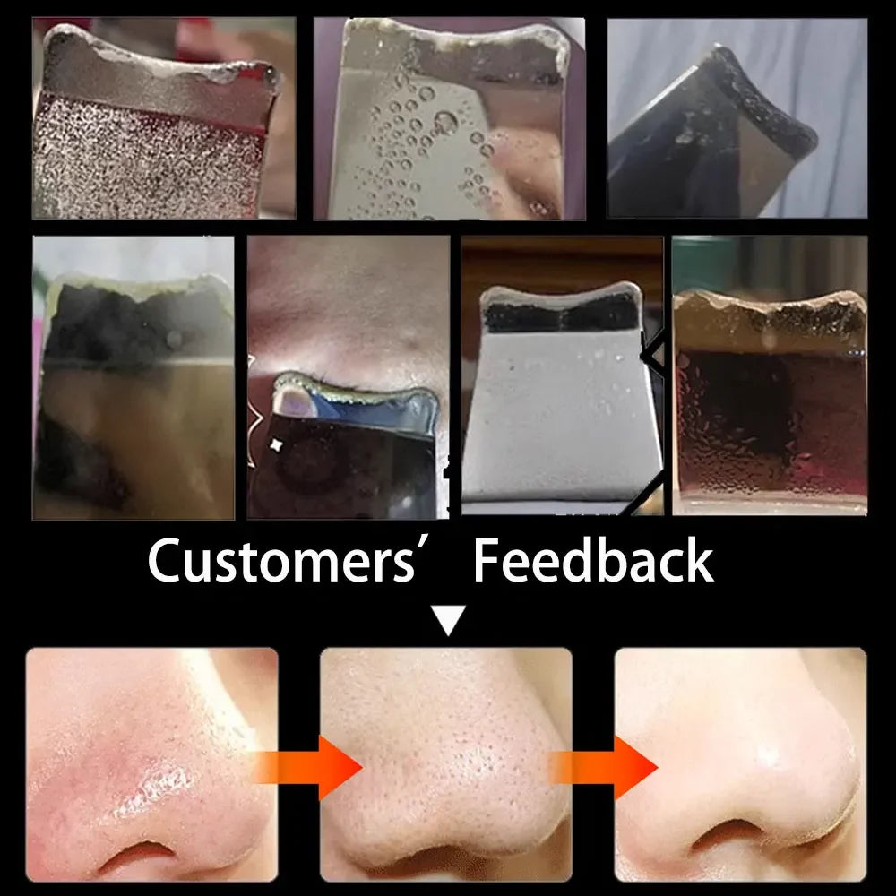 Glow Up: Ultrasonic Facial Scrubber for Radiant, Clear Skin